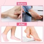 Silicone Moisturizing Gel Heel Socks for Dry Cracked Feet Reusable Foot Care Socks for Women
